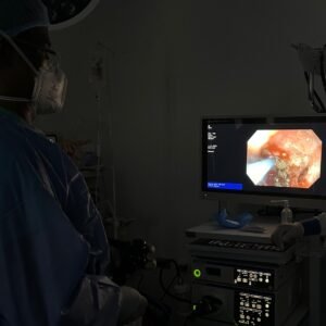 Laser de Argon Endoscópico