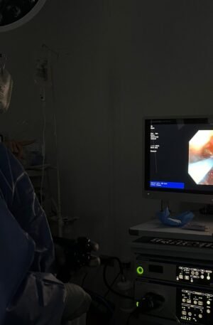 Laser de Argon Endoscópico