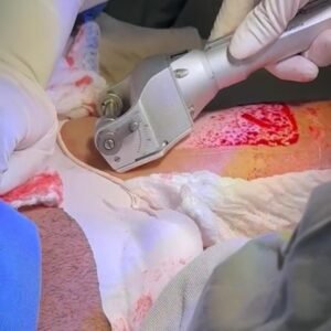 Dermatomo Neumático