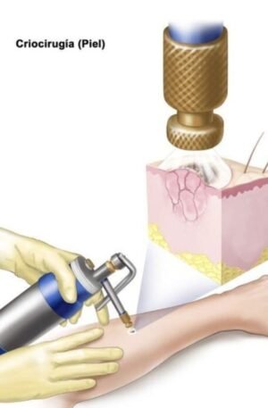 Equipor de Crioterapia